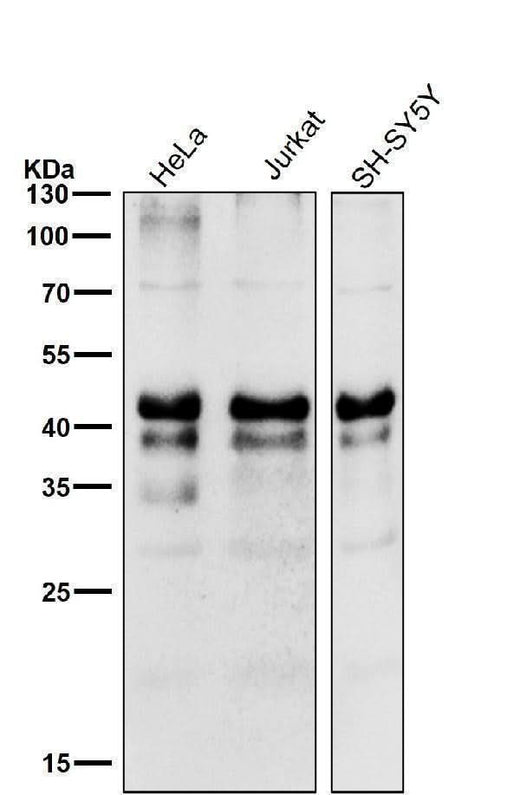 Anti-Phospho-Creb (S133) CREB1 Rabbit Monoclonal Antibody Boster Bio