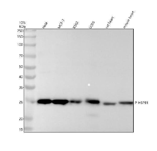 Anti-Phospho-Hsp27 (S82) HSPB1 Rabbit Monoclonal Antibody Boster Bio