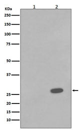 Anti-Phospho-Hsp27 (S78) HSPB1 Rabbit Monoclonal Antibody Boster Bio