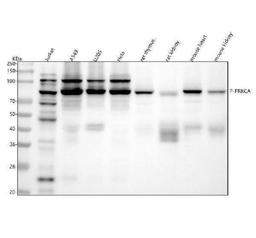 Anti-Phospho-PKC alpha (T638) PRKCA Rabbit Monoclonal Antibody Boster Bio