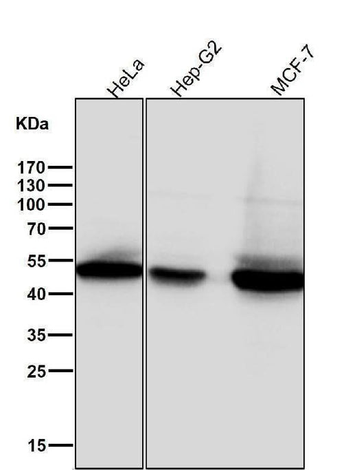 Anti-Phospho-GSK3 beta (Ser9) Rabbit Monoclonal Antibody Boster Bio