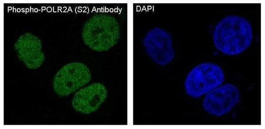 Anti-Phospho-POLR2A (S2) Rabbit Monoclonal Antibody Boster Bio