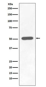 Anti-Phospho-Chk1 (S296) CHEK1 Rabbit Monoclonal Antibody Boster Bio