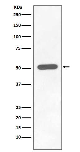 Anti-Phospho-Chk1 (S296) CHEK1 Rabbit Monoclonal Antibody Boster Bio