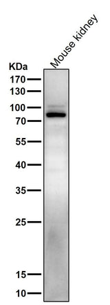 Anti-Phospho-Stat5 (Y694) STAT5A Rabbit Monoclonal Antibody Boster Bio