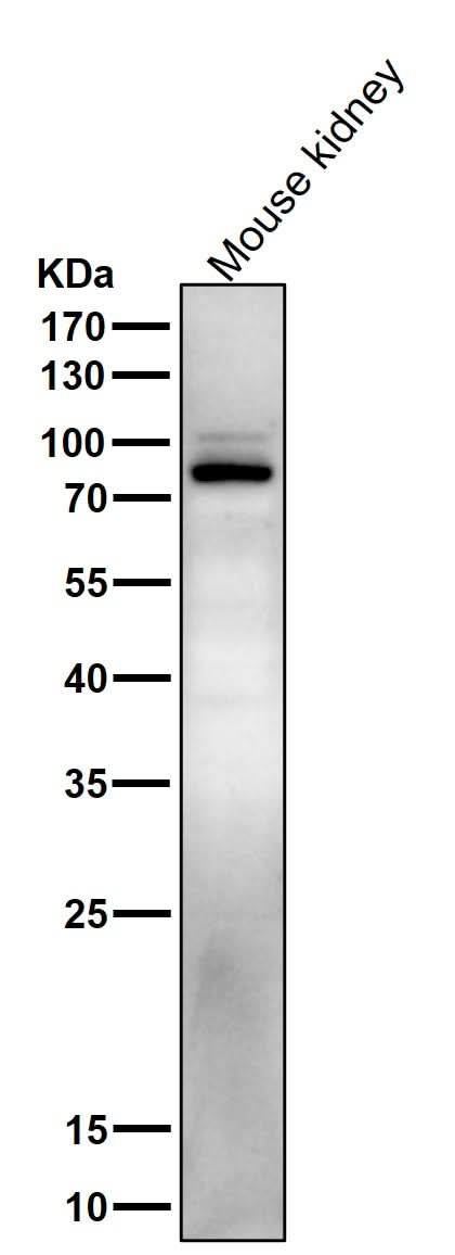 Anti-Phospho-Stat5 (Y694) STAT5A Rabbit Monoclonal Antibody Boster Bio