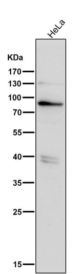 Anti-Phospho-PKR (T446) EIF2AK2 Rabbit Monoclonal Antibody Boster Bio