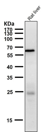 Anti-Phospho-AMPK alpha 2 (S491) PRKAA2 Rabbit Monoclonal Antibody Boster Bio