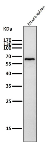 Anti-Phospho-AMPK alpha (T172) PRKAA2 Rabbit Monoclonal Antibody Boster Bio