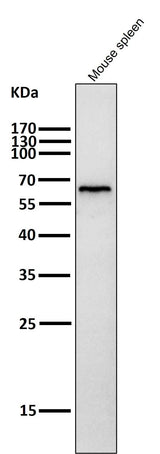 Anti-Phospho-AMPK alpha (T172) PRKAA2 Rabbit Monoclonal Antibody Boster Bio