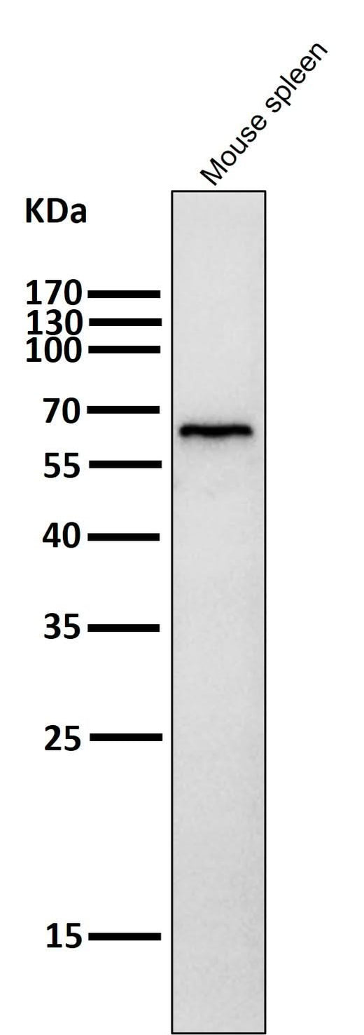 Anti-Phospho-AMPK alpha (T172) PRKAA2 Rabbit Monoclonal Antibody Boster Bio
