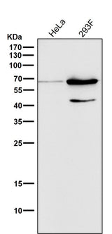 Anti-Phospho-AMPK alpha 2 (S345) PRKAA2 Rabbit Monoclonal Antibody Boster Bio