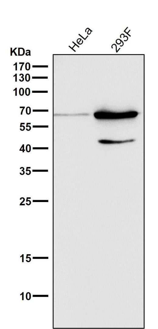 Anti-Phospho-AMPK alpha 2 (S345) PRKAA2 Rabbit Monoclonal Antibody Boster Bio