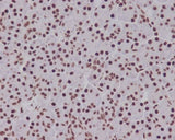 Anti-Phospho-Smad5 (S463/465) Rabbit Monoclonal Antibody Boster Bio