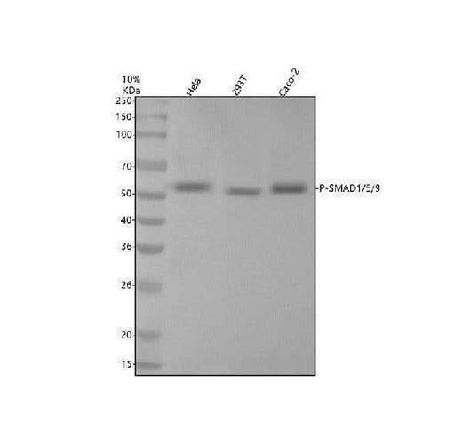 Anti-Phospho-Smad1/5/9 (S463/S465/S467) Rabbit Monoclonal Antibody Boster Bio