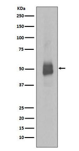 Anti-Phospho-Lyn (Y396) Rabbit Monoclonal Antibody Boster Bio