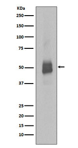 Anti-Phospho-Lyn (Y396) Rabbit Monoclonal Antibody Boster Bio