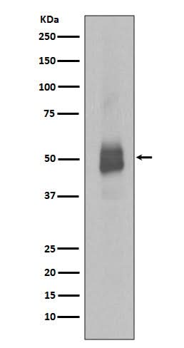 Anti-Phospho-Lyn (Y396) Rabbit Monoclonal Antibody Boster Bio