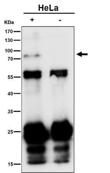 Anti-Phospho-TAK1 (S439) Rabbit Monoclonal Antibody Boster Bio