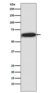 Anti-Phospho-S6K1 (T421 + S424) RPS6KB1 Rabbit Monoclonal Antibody Boster Bio
