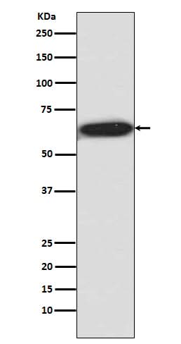Anti-Phospho-S6K1 (T421 + S424) RPS6KB1 Rabbit Monoclonal Antibody Boster Bio