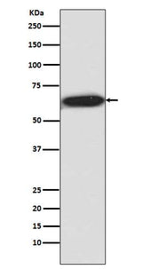 Anti-Phospho-S6K1 (T421 + S424) RPS6KB1 Rabbit Monoclonal Antibody Boster Bio
