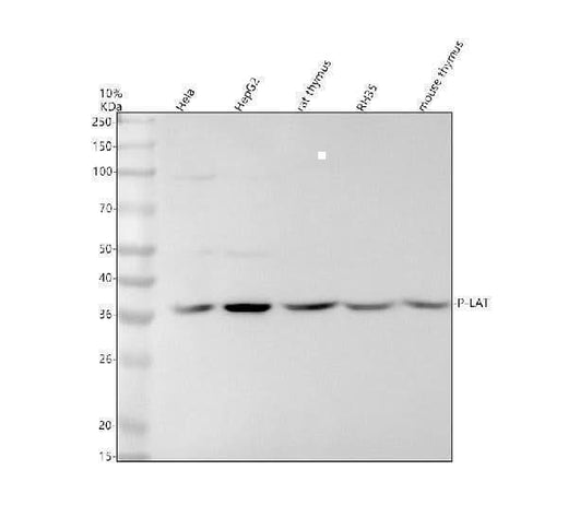 Anti-Phospho-LAT (Y191) Rabbit Monoclonal Antibody Boster Bio