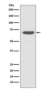 Anti-Phospho-PKC zeta (T560) PRKCZ Rabbit Monoclonal Antibody Boster Bio