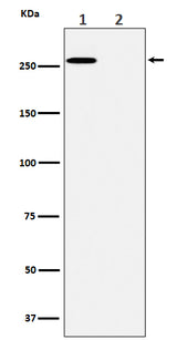 Anti-Phospho-ACC(S80) Rabbit Monoclonal Antibody Boster Bio