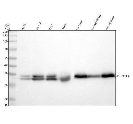 Anti-Phospho-PP2A alpha (Y307) PPP2CA Rabbit Monoclonal Antibody Boster Bio