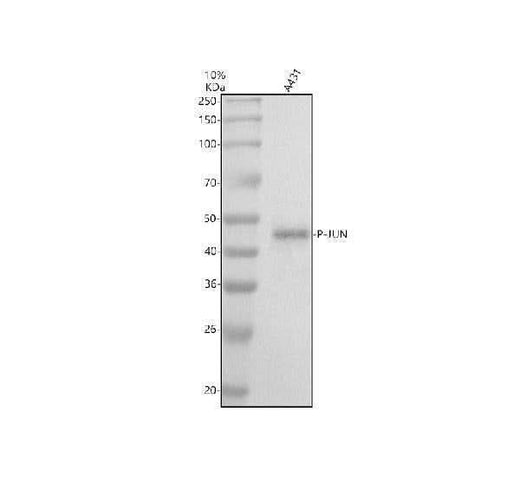 Anti-Phospho-c-Jun (T91) Rabbit Monoclonal Antibody Boster Bio