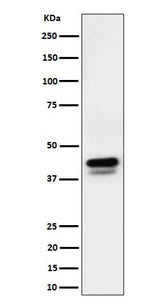 Anti-Phospho-c-Jun (S73)+JunD (S100) Rabbit Monoclonal Antibody Boster Bio