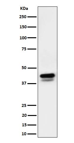 Anti-Phospho-c-Jun (S73)+JunD (S100) Rabbit Monoclonal Antibody Boster Bio
