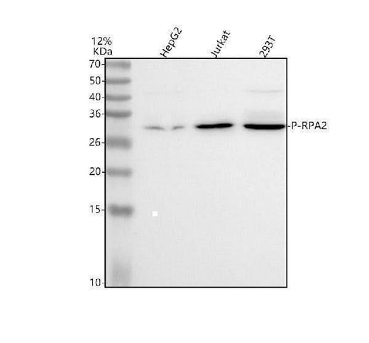 Anti-Phospho-RPA2 (T21) Rabbit Monoclonal Antibody Boster Bio