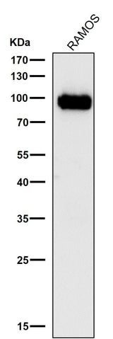 Anti-Phospho-CDC37 (S13) Rabbit Monoclonal Antibody Boster Bio