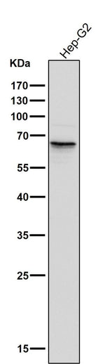 Anti-Phospho-PAK1/2/3 (S144+S141+S139) PAK3 Rabbit Monoclonal Antibody Boster Bio