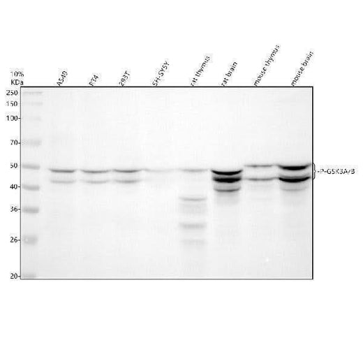 Anti-Phospho-GSK3 (alpha + beta) (Y216 + Y279) GSK3A Rabbit Monoclonal Antibody Boster Bio