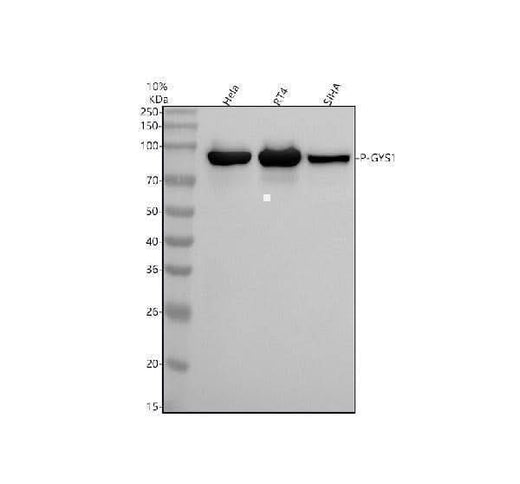 Anti-Phospho-Glycogen synthase 1 (S641) GYS1 Rabbit Monoclonal Antibody Boster Bio