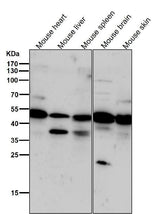 Anti-Phospho-PKA R2 (S99) PRKAR2A Rabbit Monoclonal Antibody Boster Bio