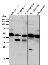 Anti-Phospho-PKA R2 (S99) PRKAR2A Rabbit Monoclonal Antibody Boster Bio