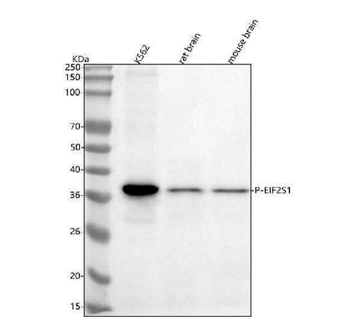 Anti-Phospho-EIF2S1 (S51) Rabbit Monoclonal Antibody Boster Bio
