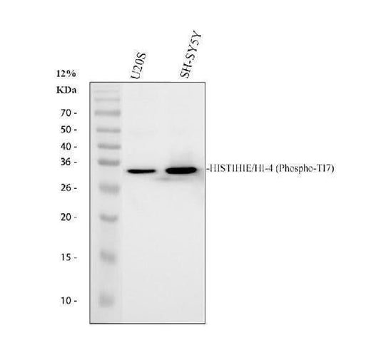 Anti-Phospho-Histone H1.4 (T17) HIST1H1E Rabbit Monoclonal Antibody Boster Bio