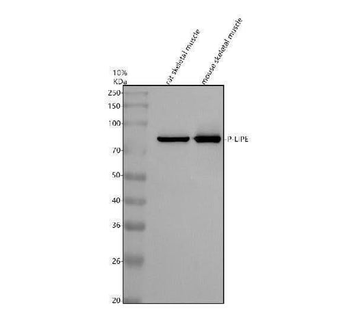 Anti-Phospho-HSL (S853) LIPE Rabbit Monoclonal Antibody Boster Bio