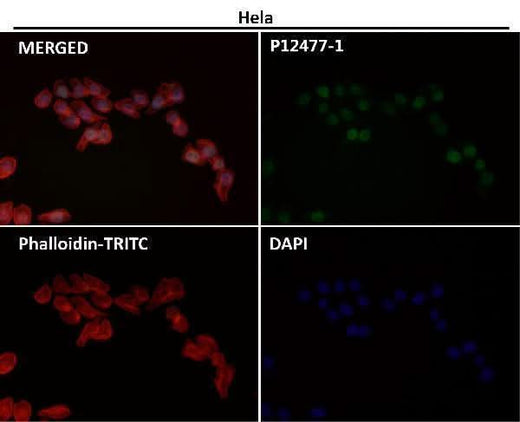 Anti-Histone H3 (acetyl K56) HIST1H3A Rabbit Monoclonal Antibody Boster Bio