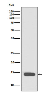 Anti-Histone H2B (acetyl K20) HIST1H2BB Rabbit Monoclonal Antibody Boster Bio