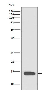 Anti-Histone H2B (acetyl K20) HIST1H2BB Rabbit Monoclonal Antibody Boster Bio