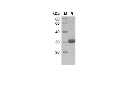 SDS-PAGE analysis of Human CCL27 proteins, 2 μg/lane of Recombinant Human CCL27 proteins was resolved with an SDS-PAGE under reducing conditions, showing bands at 29.6 kDa.