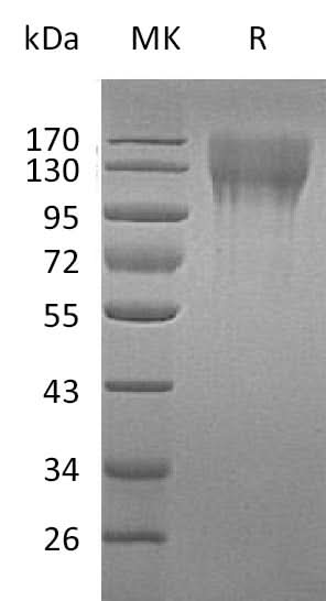 Recombinant Mouse CD96 Protein (His Tag) - ABMIUM