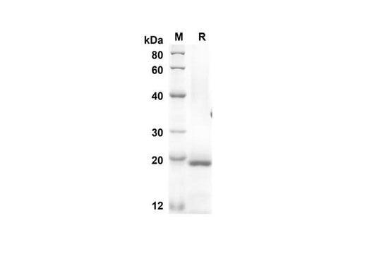 SDS-PAGE analysis of Mouse ESM1 proteins, 2 μg/lane of Recombinant Mouse ESM1 proteins was resolved with an SDS-PAGE under reducing conditions, showing bands at 17.8 kDa.
