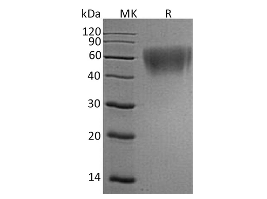 Recombinant Human ICOS Ligand/ICOSL Protein (His Tag) - ABMIUM